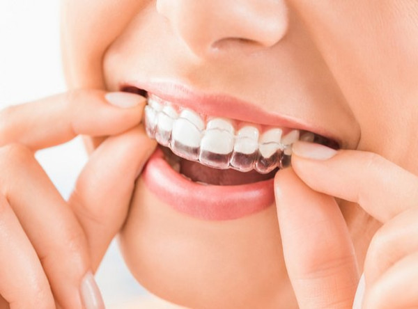 Zahnbehandlung - Schienentherapie